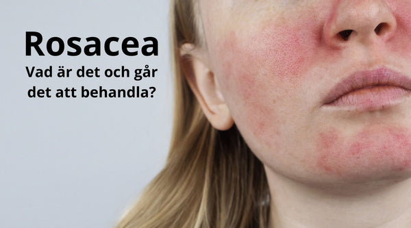 Rosacea