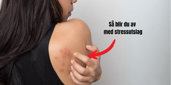 Så behandlar du stressutslag i ansiktet - Orsak och behandling